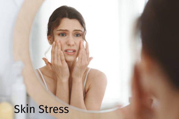 Skin Stress