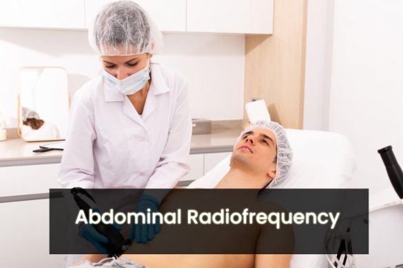 Abdominal Radiofrequency